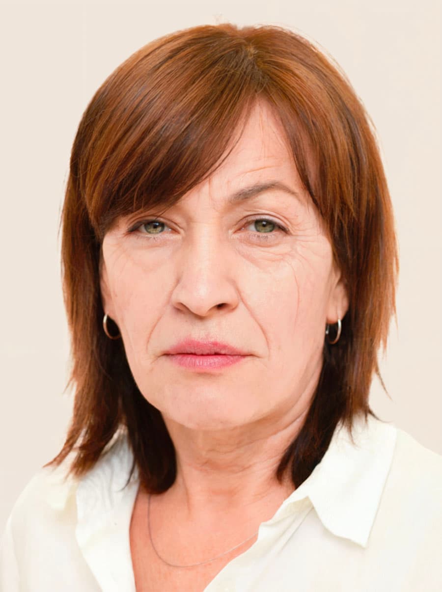 Facelift před - vygenerováno generativní umělou inteligencí