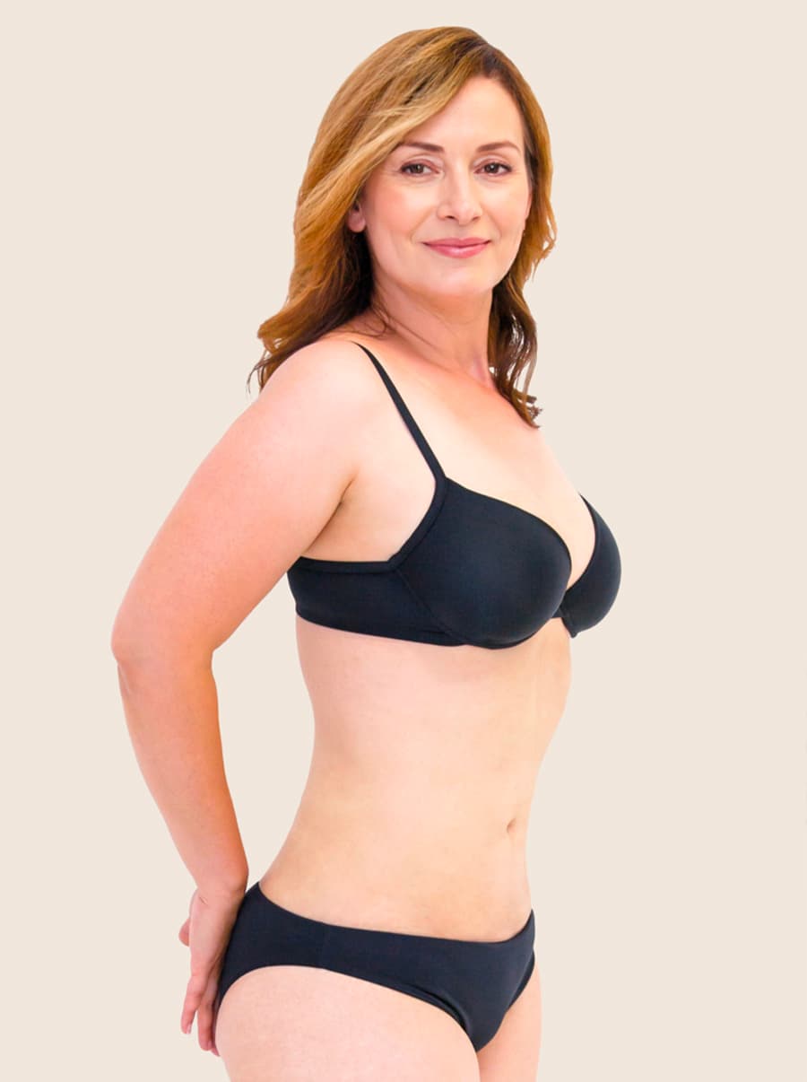 Liposukce po - vygenerováno generativní umělou inteligencí