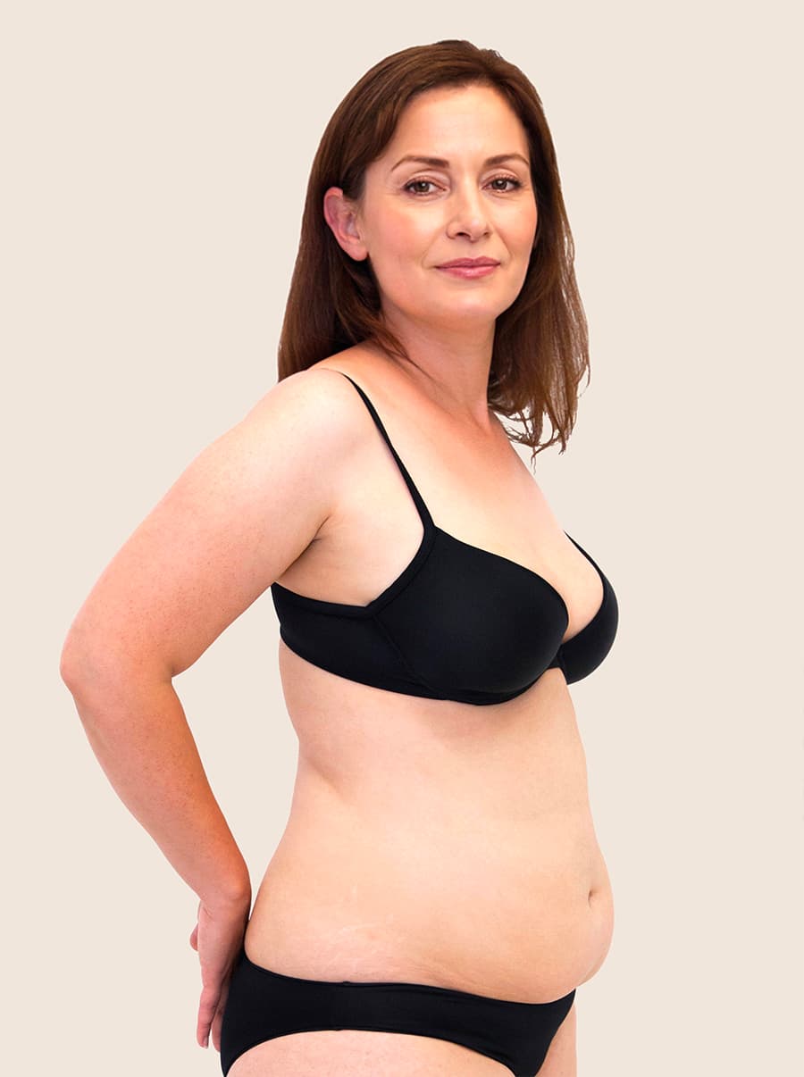 liposukce pred - vygenerováno generativní umělou inteligencí