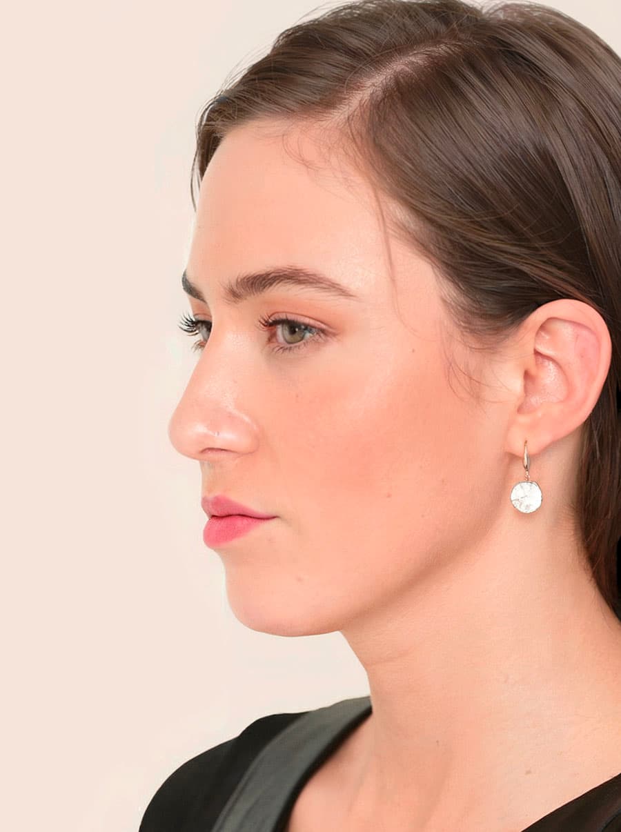 Rhinoplastika po - vygenerováno generativní umělou inteligencí