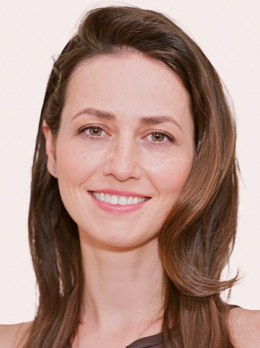 Výplně kyselinou hyaluronovou po - vygenerováno generativní umělou inteligencí